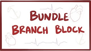 Bundle branch block  causes, symptoms, diagnosis, treatment, pathology