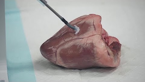 This tiny robot could 3D print inside your body to make repairs and fight cancer