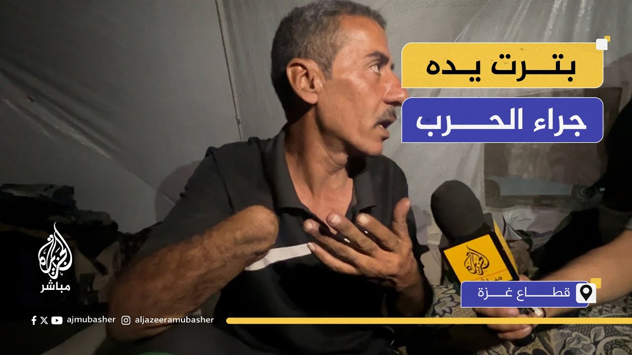 تبدلت حياته رأسا على عقب.. نازح بتـ.ـرت يده ويعول أسرة كبيرة