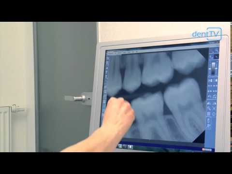 Video: Lina in der Zahnmedizin: Ärzte treffen