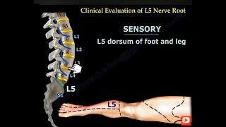 NERVE INJURIES OF THE LOWER EXTREMITY. Foot drop, tarsal tunnel syndrome and Morton's neuroma.