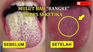Bau Mulut Ludes Seketika Dengan Air Ajaib Ini