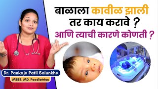 बळल कवळ हणयच करण कणत ? बळल कवळ झलयस कय करव ? Causes Of Jaundice In Babies