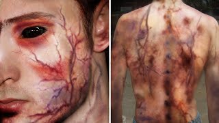 Kaza Sonrası Gerçek Süper Güçlere Sahip Olan 11 Kişi