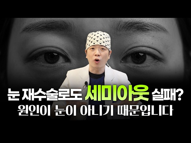 세미아웃실패, 반복되는 진짜 원인운? 이마가 문제일수도 있습니다!ㅣ디에이성형외과ㅣ수직이마거상효과