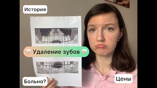 Удаление Моих Зубов// Цены// Больно ли?// Киста Зуба