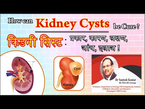 Kidney Cyst. Kidney Tumor. Kidney Cancer | किडनी सिस्ट | Dr.(Prof)Santosh Kumar PGI.