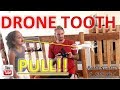 DRONE Tooth Pull!!... FAIL