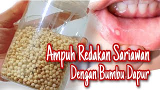 Download Lagu Resep JSR dr. Zaidul Akbar Untuk Meredakan Sariawan dan Mencegah Bau Mulut MP3
