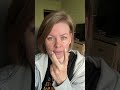Пластика носа ч1 #пластиканоса #лорврач #синусит #стоматология #офтальмолог