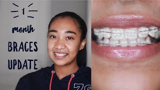 One Month Braces Update | Pain, Elastics, Teeth Moving | Shes Mishka |South African Youtuber