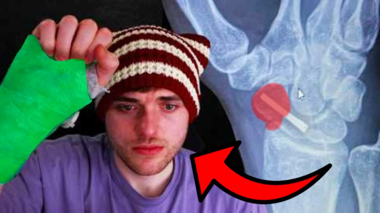 Minecraft Injury Dream Broke His Wrist… And It Could Change Minecraft Forever - YouTube