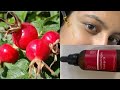 Rosehip oil for young and beautiful looking skin ||Telugu