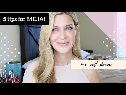 MILIA | 5 top tips to keep them away!