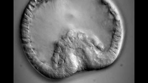 Development II (Sea Urchin Gastrulation)