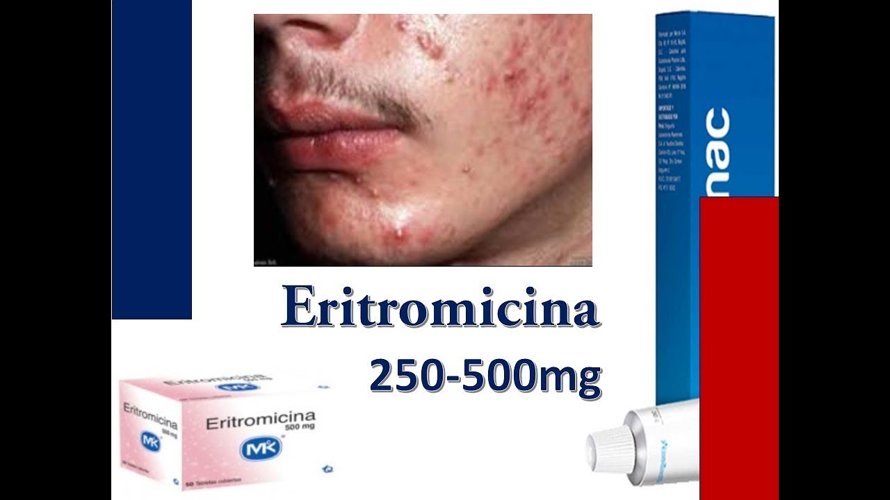 ERITROMICINA, PARA QUE SIRVE ERITROMICINA, ERITROMICINA PARA