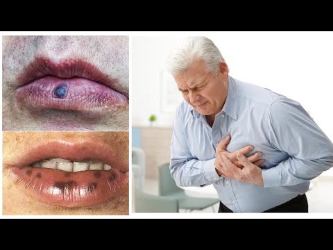 Video: 4 mënyra të lehta për të zgjedhur ngjyrën e buzëve