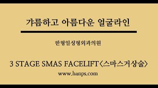 안면거상수술 잘하는 성형외과 안면거상 방법 및 안면거상 회복기간 안면거상 수술 후 효과