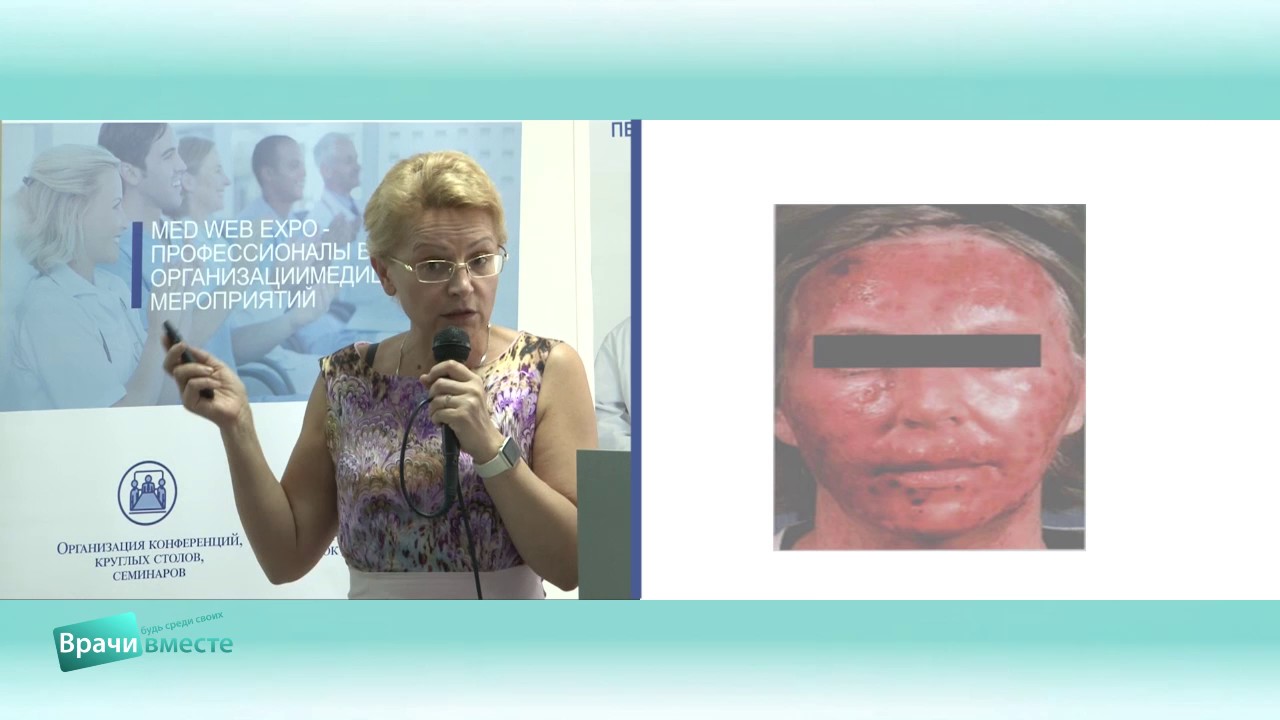 Герпетическая инфекция на современном этапе. Что нового в тактике ...