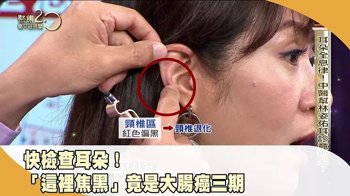 快檢查耳朵！ 「這裡焦黑」竟是大腸癌三期 【聚焦2.0】第483集 - 天天要聞