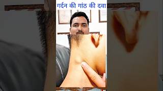 गलट और गठ क दव Lymph Nodes Enlargement Medicine Homeopathy Cystnodules Medicine