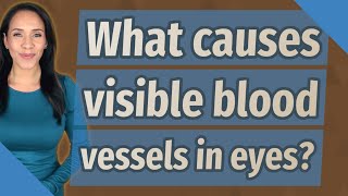 What causes visible blood vessels in eyes?