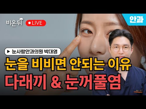 [제주] 안과상담소 - 눈을 비비면 안되는 이유(다래끼, 눈꺼풀염) / 눈사랑안과의원 <strong>박대영</strong>