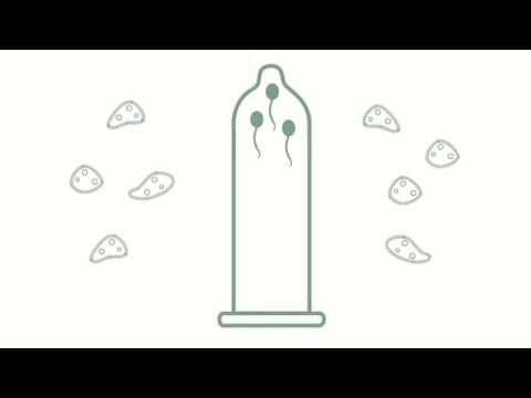ვიდეო: როგორ გამოვიყენოთ ქალის პრეზერვატივი