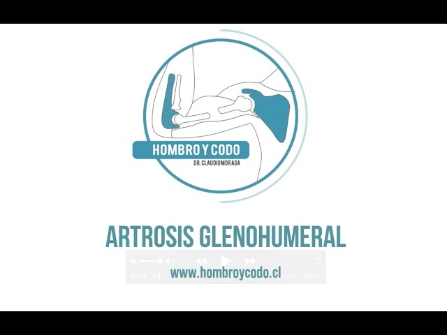 Hombro: Artrosis (glenohumeral)