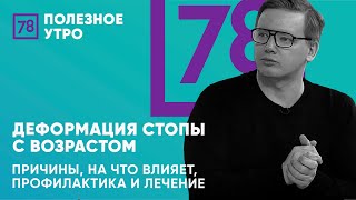 Деформация стопы с возрастом. Причины, на что влияет, профилактика и лечение| Доктор Алексей Олейник