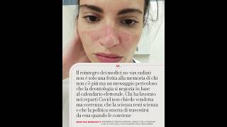L’infermiera Della Foto Simbolo Del Covid: “Il Reintegro Dei No Vax Una Ferita Alla Memoria”