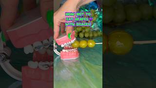 Celebrity 3 ways NOT to eat GRAPES with BRACES *what to eat instead #braces #grape #candy Profile