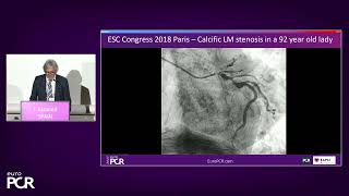 Intravascular lithotripsy in the real world: the revolution continues - EuroPCR 2023
