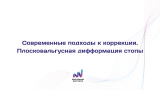 Плосковальгусная деформация стопы  Современный подход к коррекции