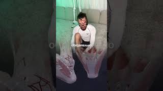 Активация подошвенного апоневроза