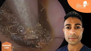 1,059 - Failed DIY Ear Wax Removals Compilation