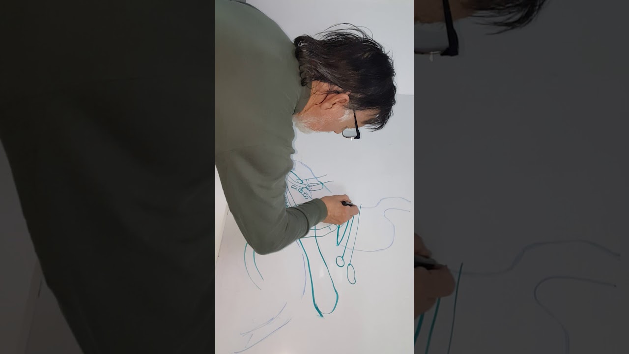 Explicación de Billroth I y Billroth II