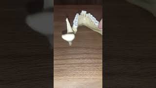 Mandible Bony Features EASY | Attachments at mandible | Skull Anatomy #mandible #neuroanatomy #bones Mandible Bony Features Easy Skull Anatomy