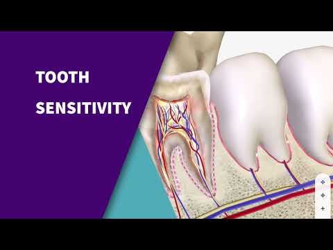 Hvorfor har du følsomme tænder | Dental Anatomy Animation