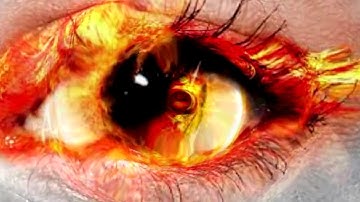 ( m²) Squaremeter # An Eye Rimmed With Fire