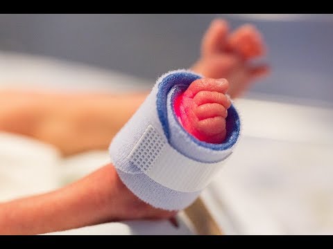 Vídeo: Nacimiento Infantil Natural: Qué Esperar, Beneficios, Riesgos, Recuperación Y Más