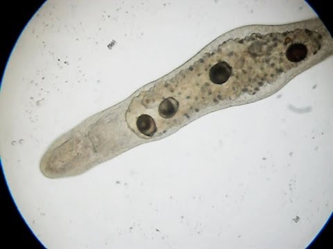 Stenostomum leucops YouTube