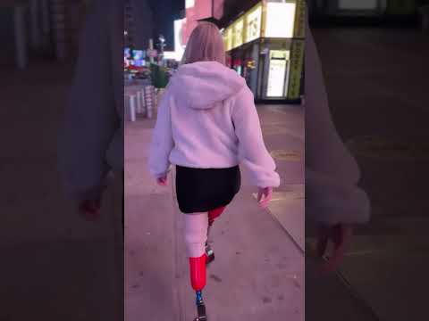 She Lost Both Legs But Walks Like a Warrior 💪🔥 #shorts