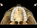 Infrazygomatic crest miniscrewschris chang orthocc569