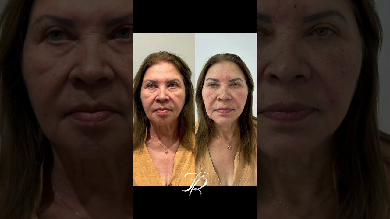 Os detalhes que fazem toda a diferença! ✨