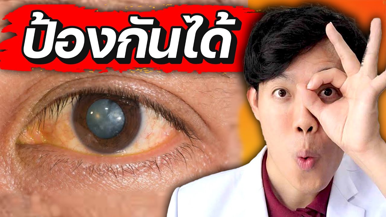5 อาหาร ชะลอ ตาเสื่อม 10 ปี (ทำตามได้ทันที) | หมอแบงค์ food doctor