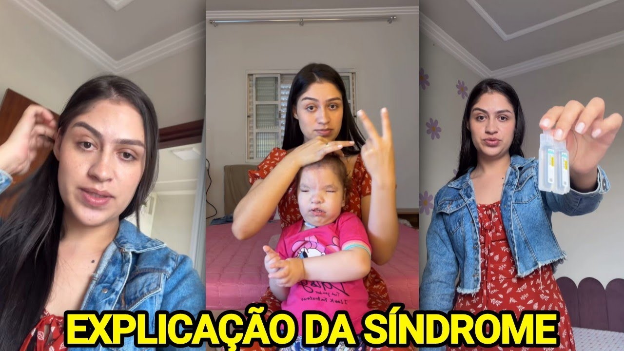 ANA VITÓRIA EXPLICA SOBRE A SÍNDROME DE PATAU DA HADASSA E MOSTRA OS CUIDADO DA MANHÃ 