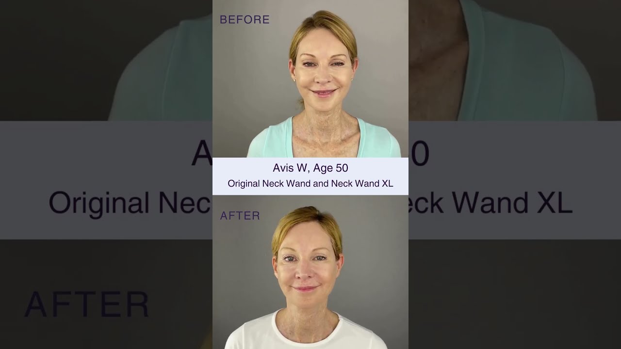 Transform Your Skin With Our Neck Chin Jawline Sculpting Wand XL 