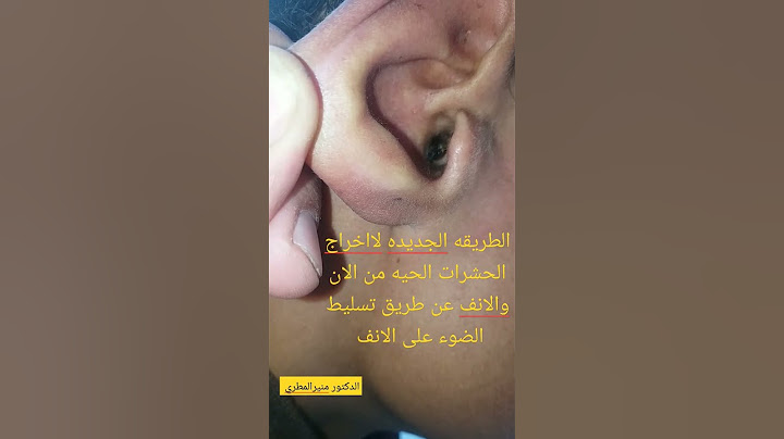 اخراج الحشرات من الاذن والانف