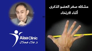 مشكله صغر العضو الذكرى أثناء الارتخاء - علاء كلينيك - 589